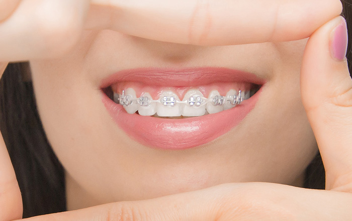 【矯正の名医の探し方】摂津市で矯正歯科を選ぶ6つのポイントを解説